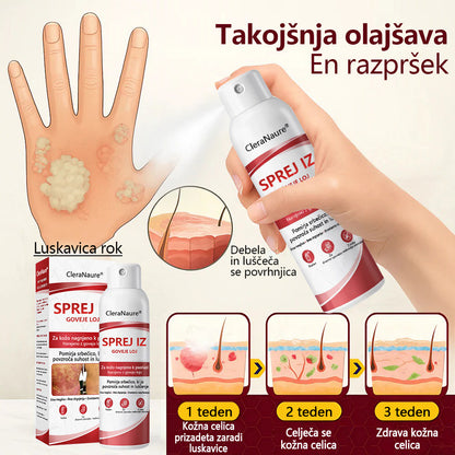 CleraNaure® Beef Tallow Spray za Srbečo in Luščečo Kožo Pri Psoriazi