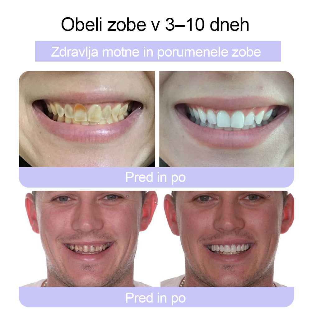 CleraNature® Prašek za obnovo zob