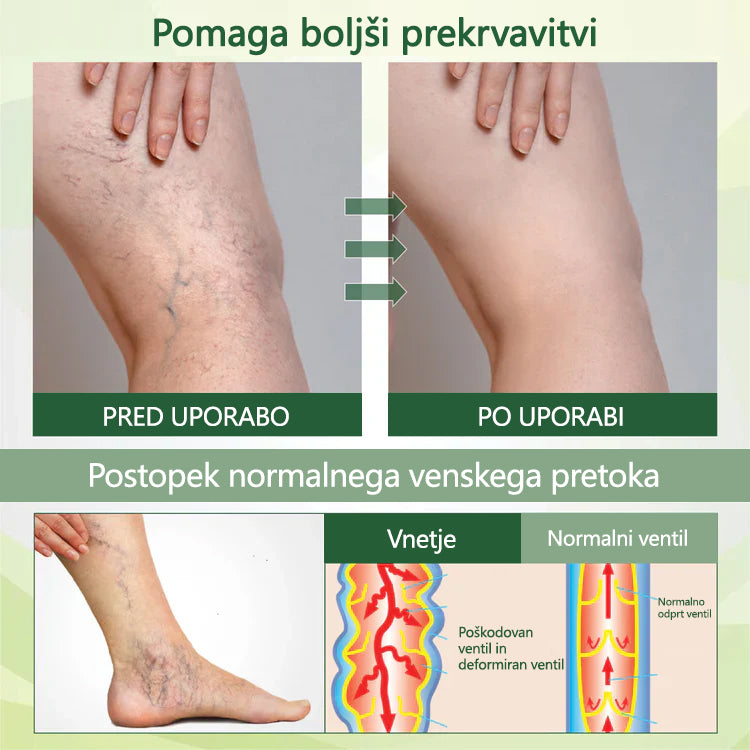 🌿 Poslovite se od otečenih, bolečih nog – CleraNaure® FluidEase Profesionalna krema za izboljšanje prekrvavitve nog prinaša pravo olajšanje! ✨🦵