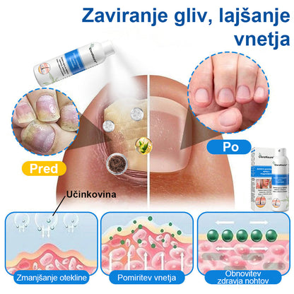 CleraNature® Magnezijev Sprej – Hitro Olajšanje za Srbečo, Rdečo in Občutljivo Kožo (tudi na intimnih predelih)