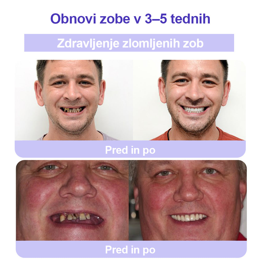 CleraNature® Prašek za obnovo zob