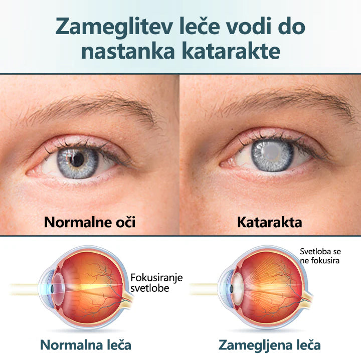 CleraNaure® OptiFusion Nano kapljice za oči