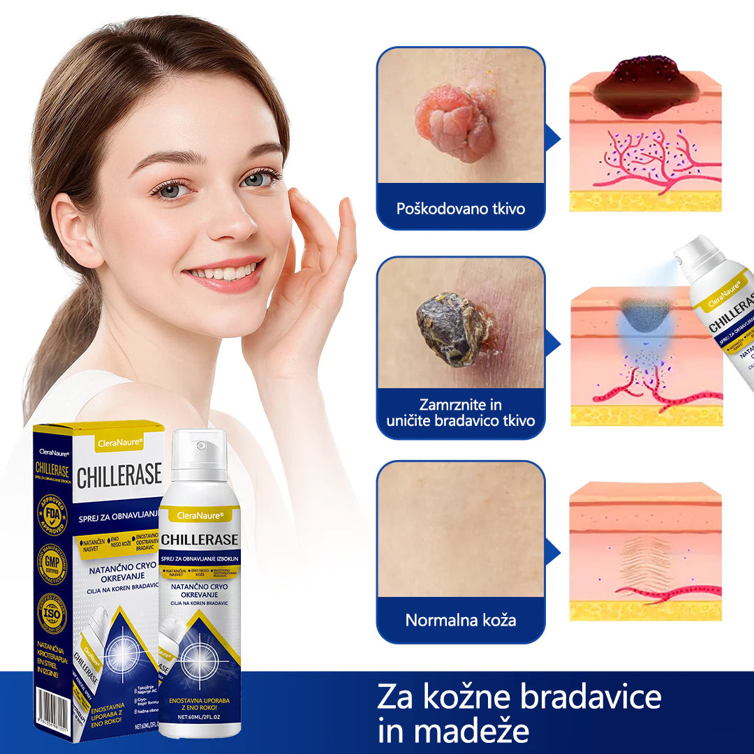 CleraNaure® ChillErase Sprej za pomlajevanje izboklin