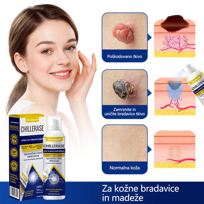 CleraNaure® ChillErase Sprej za pomlajevanje izboklin