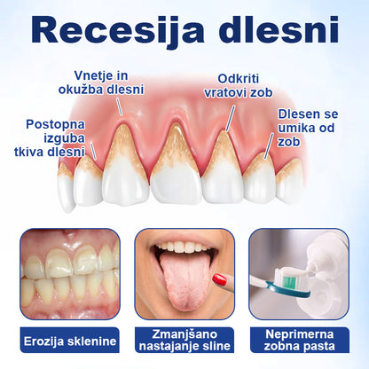 COLTURE® Kapljice za obnovo dlesni GumHoney