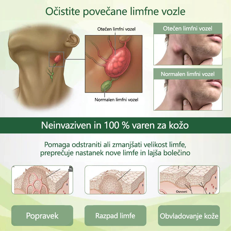 🌿 Poslovite se od otečenih, bolečih nog – CleraNaure® FluidEase Profesionalna krema za izboljšanje prekrvavitve nog prinaša pravo olajšanje! ✨🦵