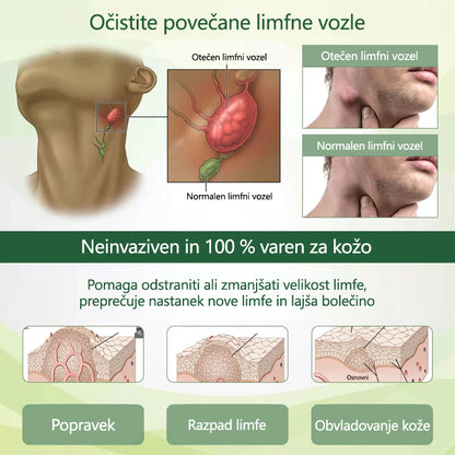 🌿 Poslovite se od otečenih, bolečih nog – CleraNaure® FluidEase Profesionalna krema za izboljšanje prekrvavitve nog prinaša pravo olajšanje! ✨🦵
