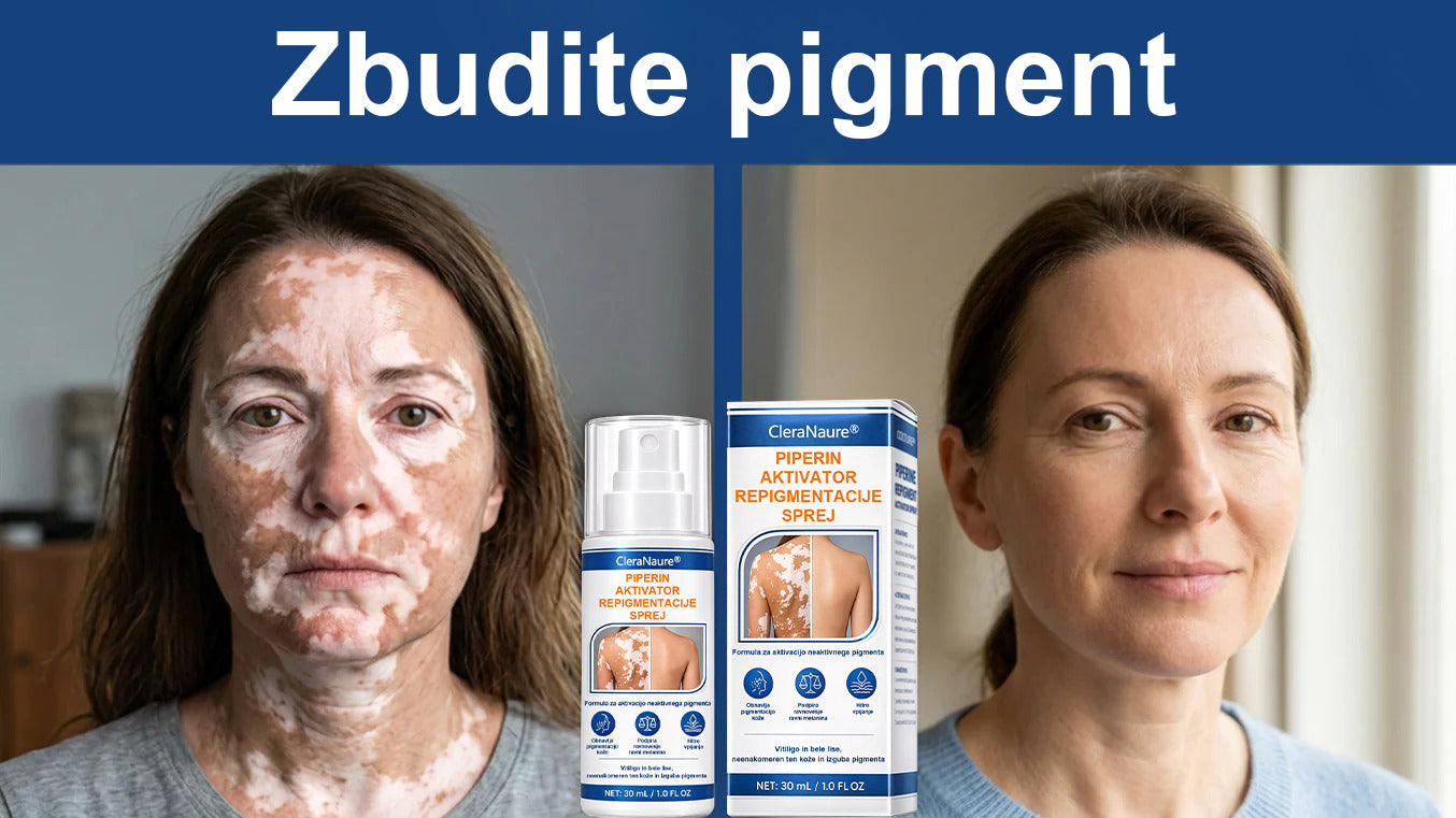 CleraNaure® Piperine Repigment Aktivator Sprej, ki aktivira neaktivne pigmentne celice in povrne naravno barvo kože.