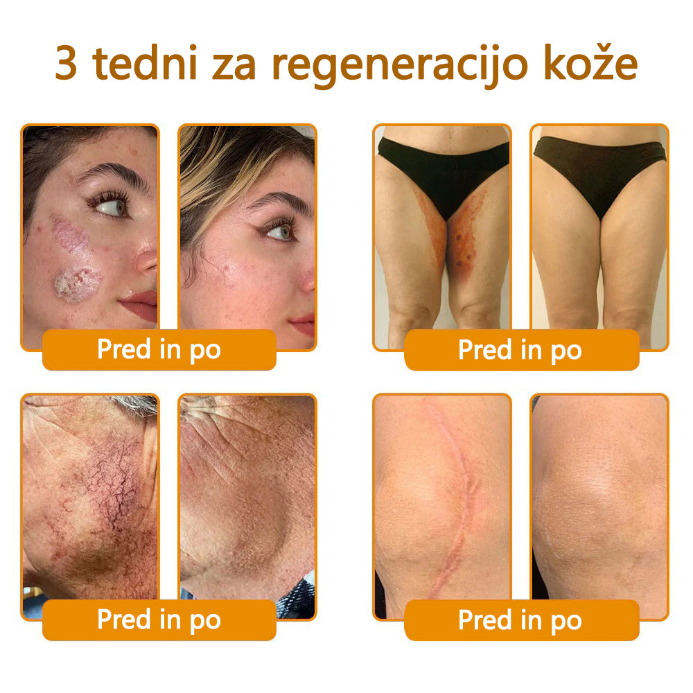 CleraNaure® krema za obnovo kože s čebeljim strupom