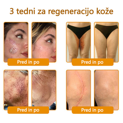 CleraNaure® krema za obnovo kože s čebeljim strupom