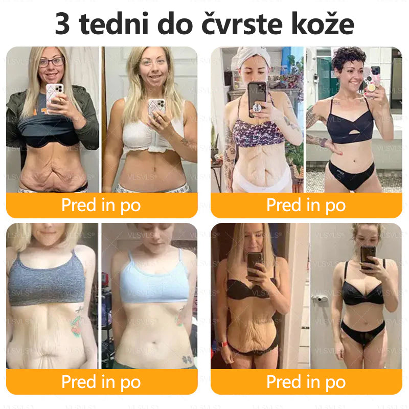 CleraNaure® krema za obnovo kože s čebeljim strupom