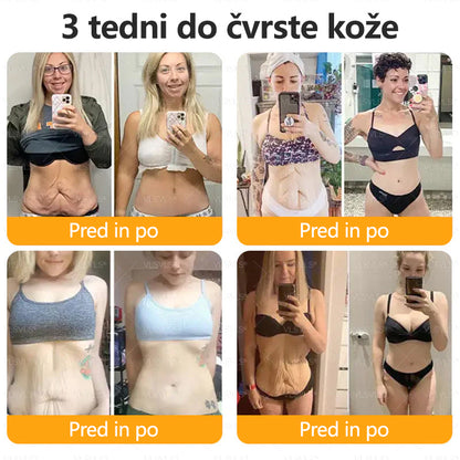 CleraNaure® krema za obnovo kože s čebeljim strupom